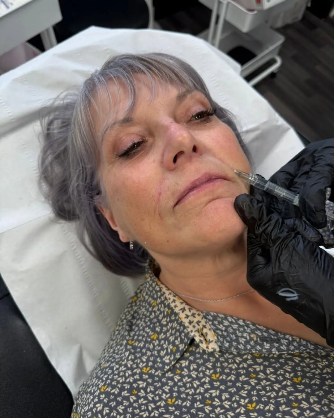 Rae Cooper carrying out a dermal filler treatment at New Aesthetics, Essex
