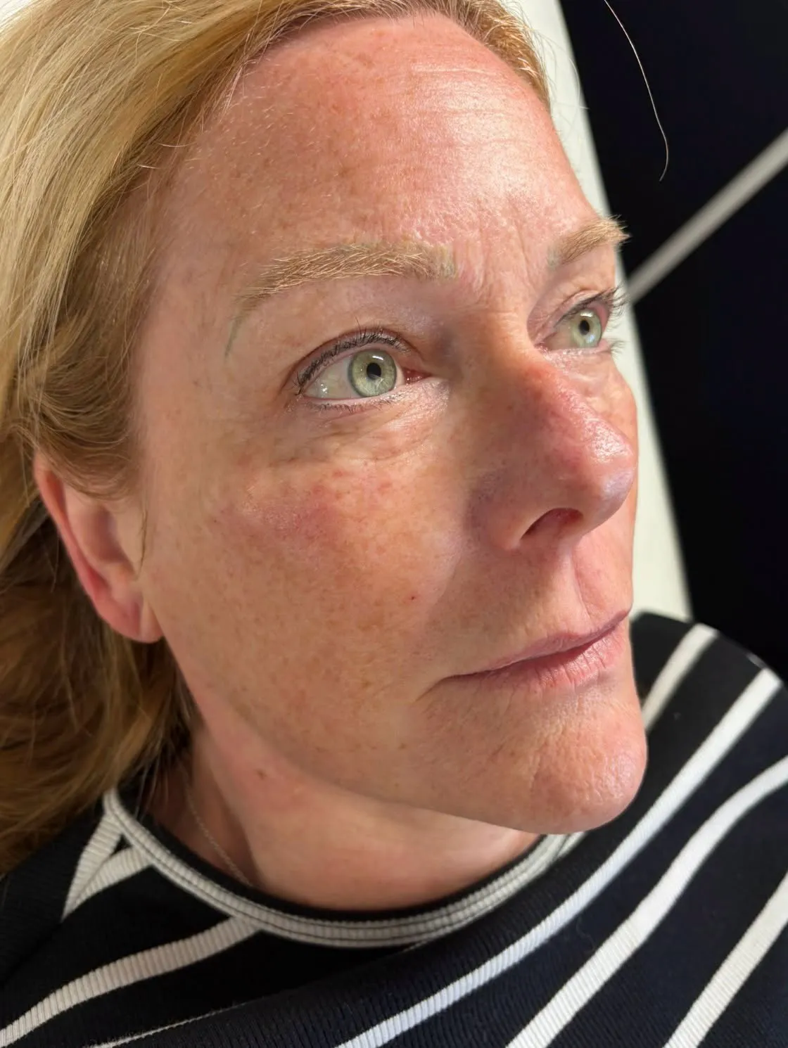 Polynucleotides result by Rae Cooper at New Aesthetics, Chelmsford and Maldon