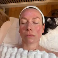 Medical-grade facial treatment at New Aesthetics, Essex