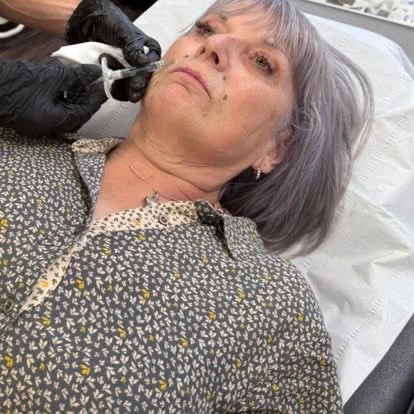 Rae Cooper carrying out a dermal filler treatment at New Aesthetics, Essex
