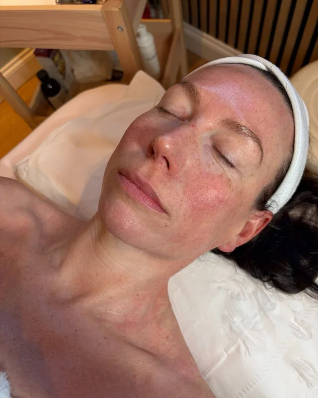 Medical-grade facial treatment at New Aesthetics, Essex