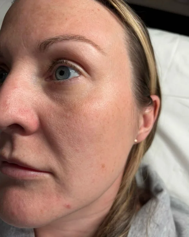 Medical-grade facial treatment at New Aesthetics, Essex