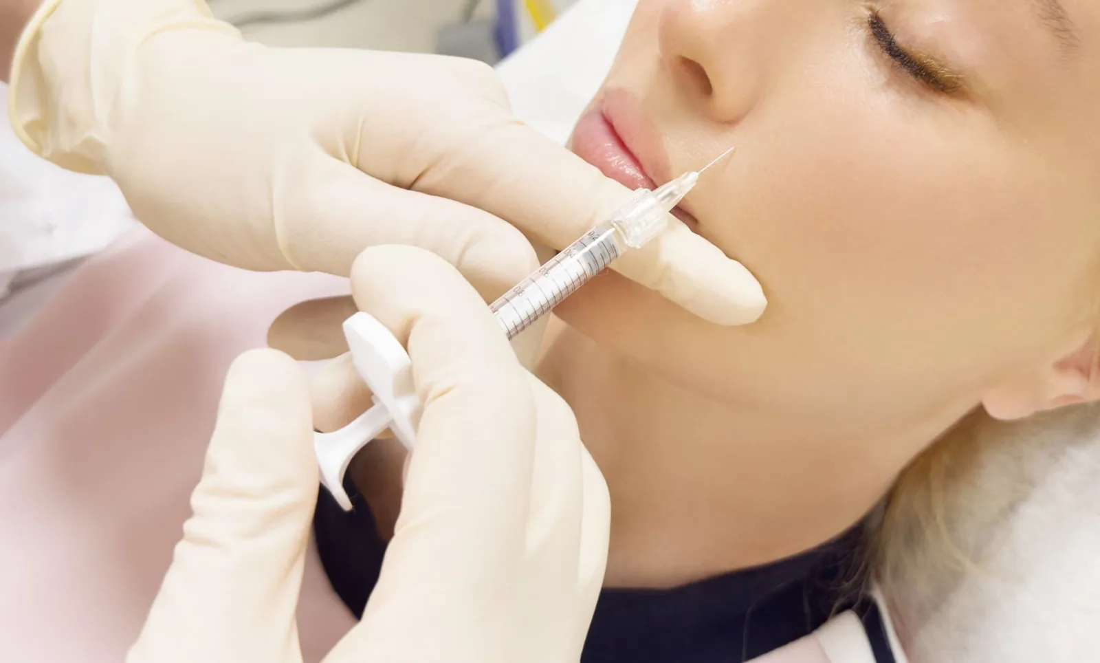 Profhilo skin booster at New Aesthetics, Chelmsford and Maldon